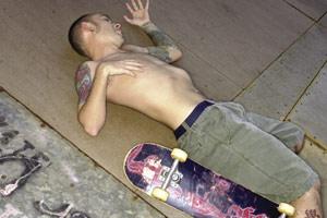 Certain seizures affect the whole body, leading the person to fall.